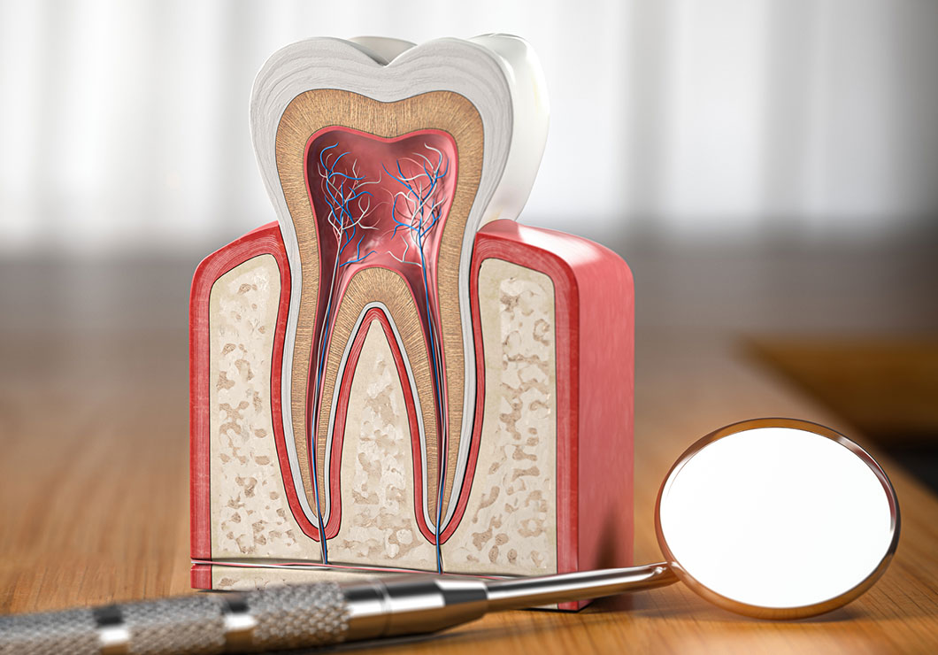 Ni-Tiファイルについて